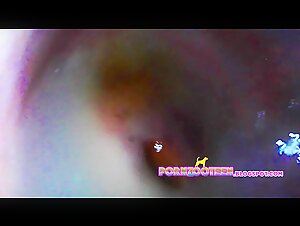 Girl Endoscope Fill up COMPILATION